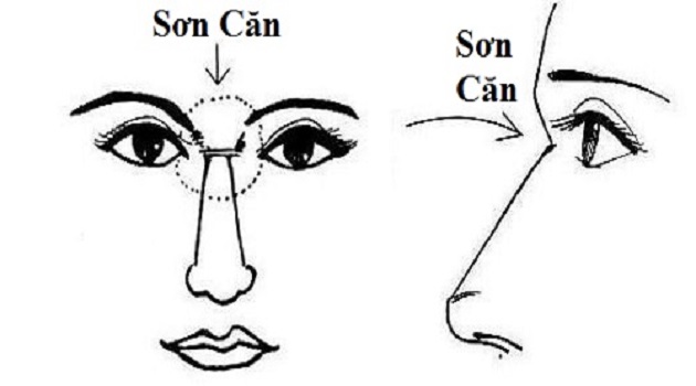 son can khuyet lom
